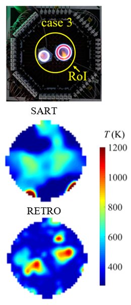 Phantom with standard and RETRO reconstruction comparisons